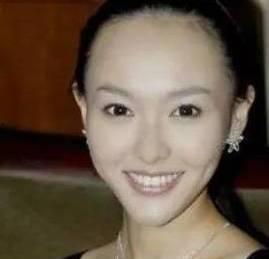 额头秃顶的明星有谁,盘点那些头顶“光景”独特的明星