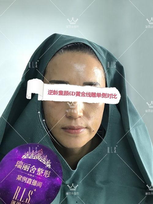 瘦脸贴明星吗,揭秘瘦脸贴的神奇魅力