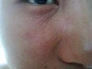 奥秘克隆感染的明星,明星们的抗疫历程与启示